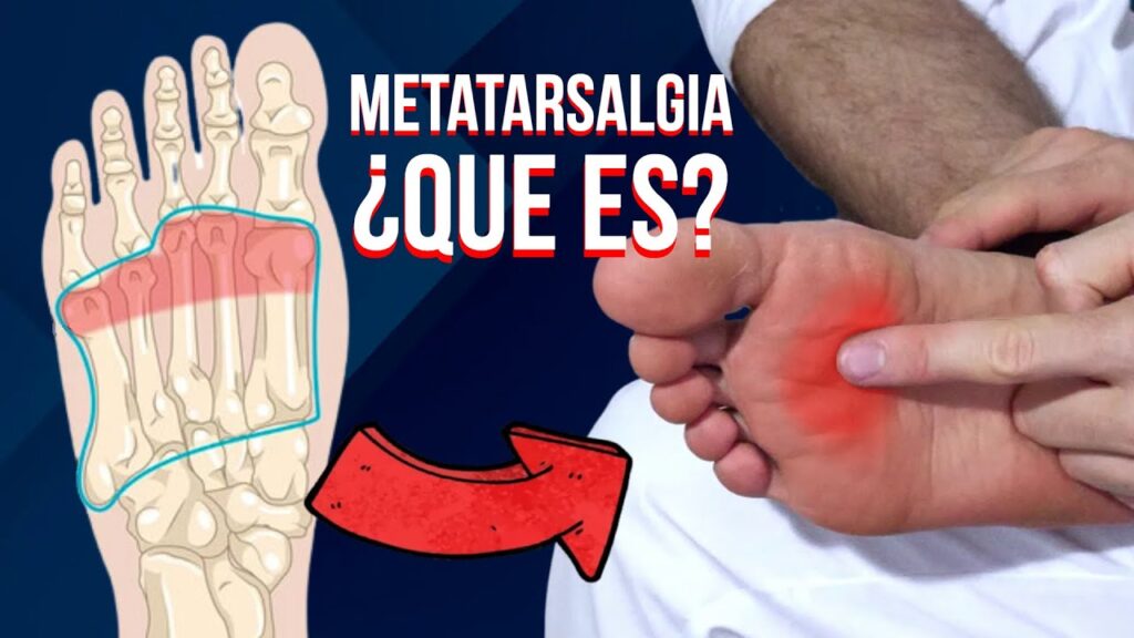 que es metatarsalgia